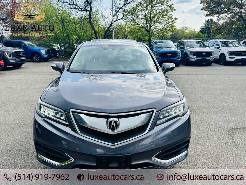 2017 Acura RDX Technology Package